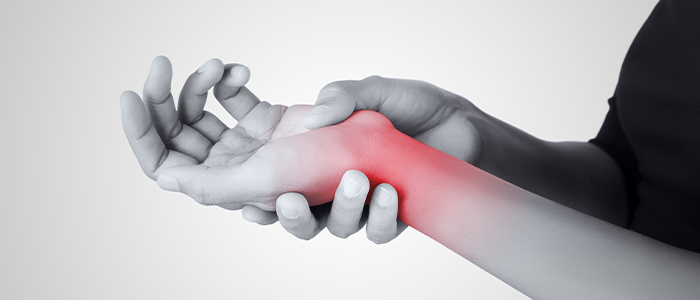Carpal tunnel syndrome: Overview, causes, symptoms, and treatment