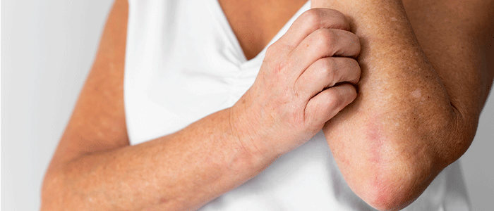 Itching without a rash: causes, symptoms and treatment
