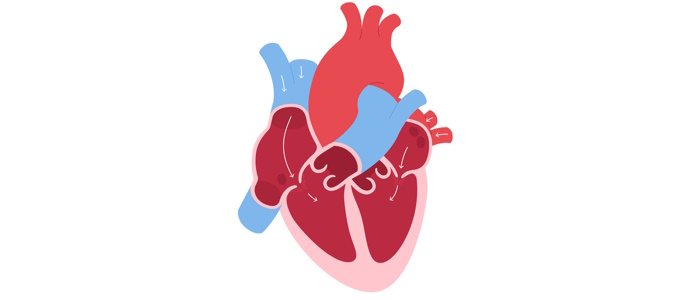 Mitral Valve Prolapse: Causes, Symptoms, and Treatment