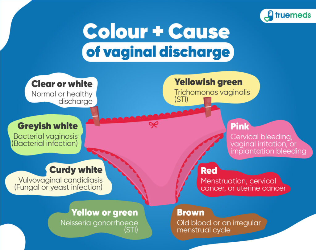 colour-and-cause-of-vaginal-discharge