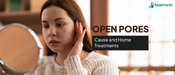 The Ultimate Guide to Remove Open Pores at Home From Its Causes to Treatment