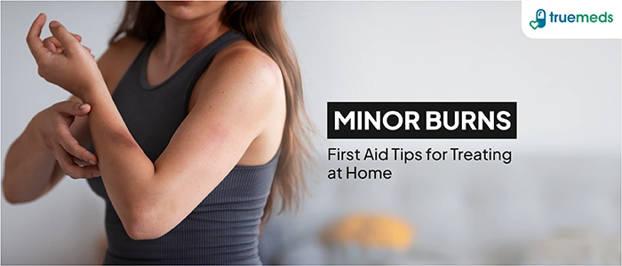 First Aid for Burns – 10 Tips for Treating Minor Burns at Home