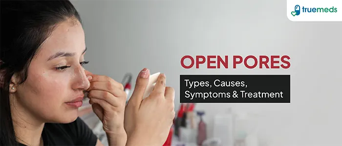 Open Pore Types, Causes, Prevention & Treatment